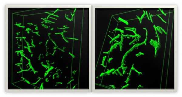 Oldneurons.jpg