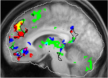 janata_brain_lg.jpg