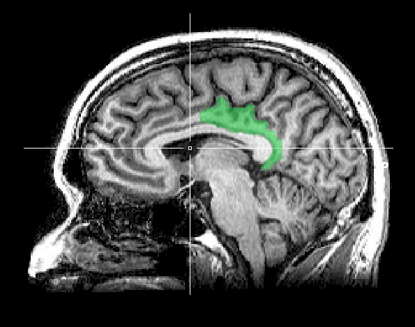 posterior cingulate cortex.jpg